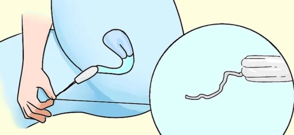 cách lấy tampon ra